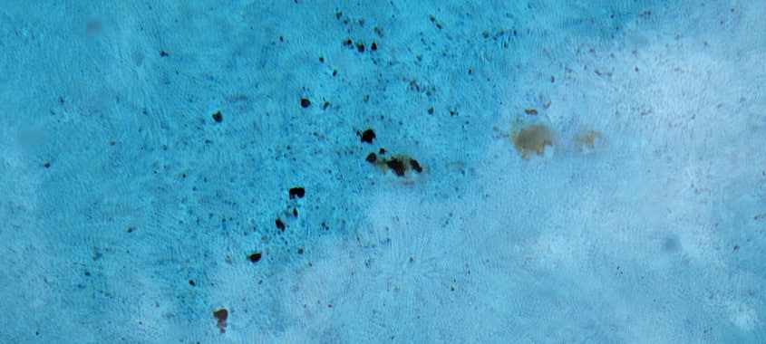 Black algae